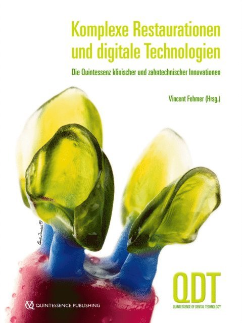 Vincent Fehmer - Komplexe Restaurationen und digitale Technologien, E-bok