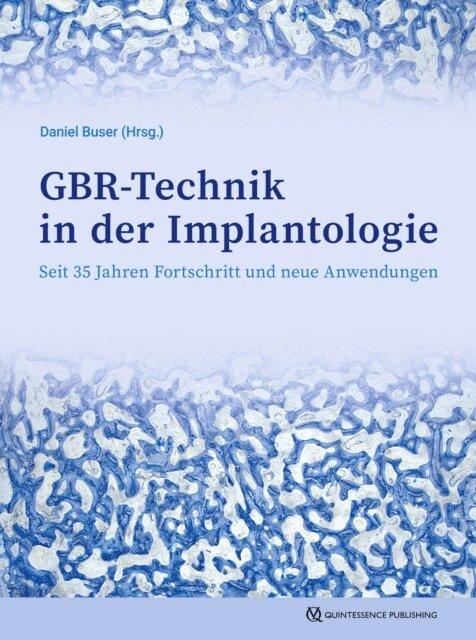 Daniel Buser - GBR-Technik in der Implantologie, E-bok