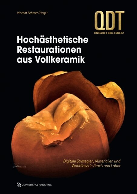 Vincent Fehmer - Hochästhetische Restaurationen aus Vollkeramik, E-bok