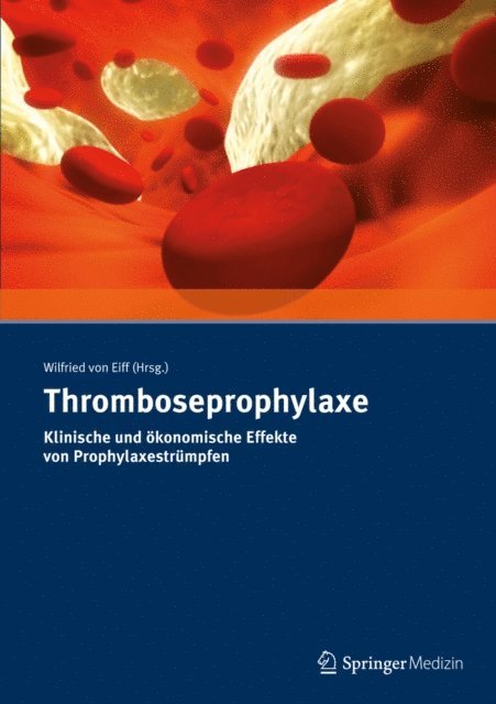 Wilfried von Eiff - Thromboseprophylaxe Klinische und ökonomische Effekte von Prophylaxestrümpfen, E-bok