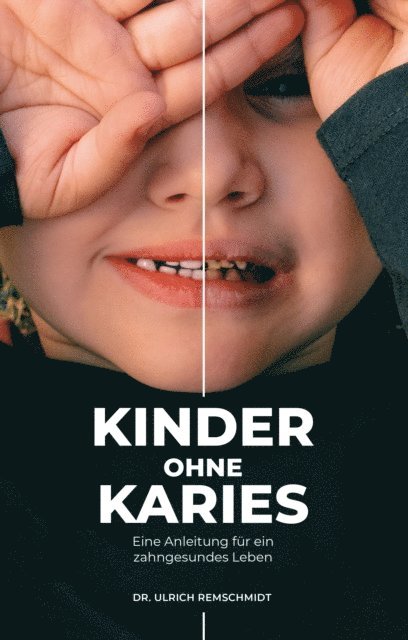 Ulrich Remschmidt - Kinder ohne Karies, E-bok