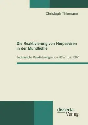Christoph Thiemann - Reaktivierung von Herpesviren in der Mundhöhle, Häftad. Tillgänglighet: Lägg i varukorg