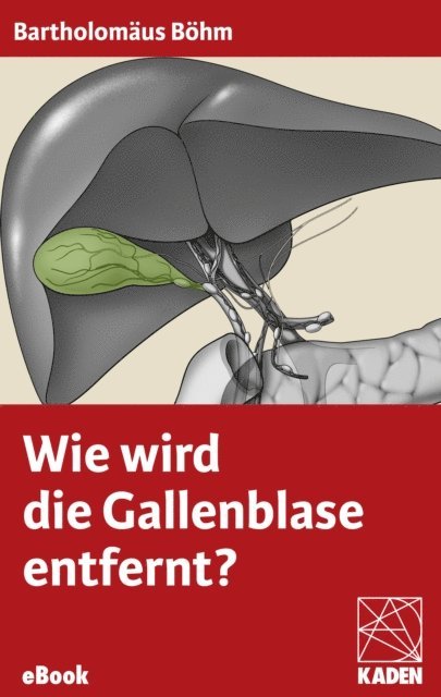 Bartholomaus Bohm - Wie wird die Gallenblase entfernt?, E-bok