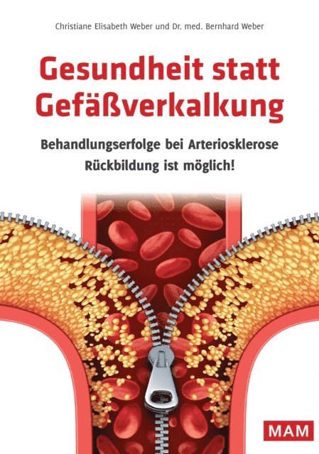 Christiane Elisabeth Weber, Dr. med. Bernhard Weber - Gesundheit statt Gefäßverkalkung, E-bok