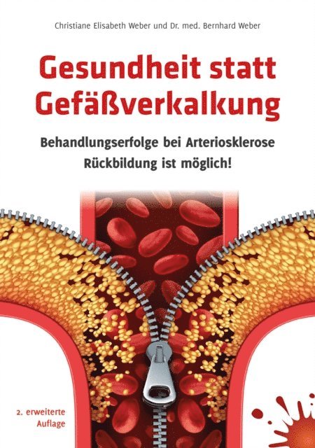 Dr. med. Bernhard Weber, Christiane Elisabeth Weber - Gesundheit statt Gefäßverkalkung, E-bok