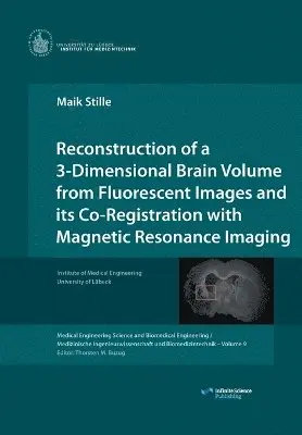 Maik Stille - Reconstruction of a 3-Dimensional Brain Volume from Fluorescent Images and its Co-Registration with Magnetic Resonance Imaging, Häftad. Tillgänglighet: Lägg i varukorg