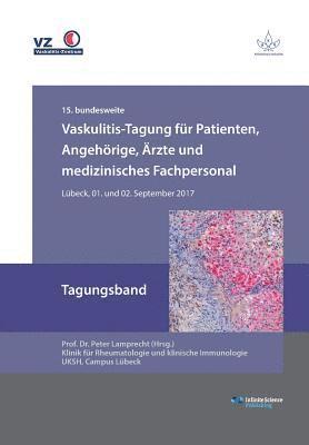 Peter Lamprecht - Vaskulitis-Tagung für Patienten, Angehörige, Ärzte und medizinisches Fachpersonal, Häftad