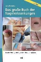 Anke Niederau - Das große Buch der Nagelerkrankungen, Inbunden
