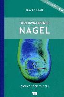 Maren Bloß - Der eingewachsenen Nagel, Häftad
