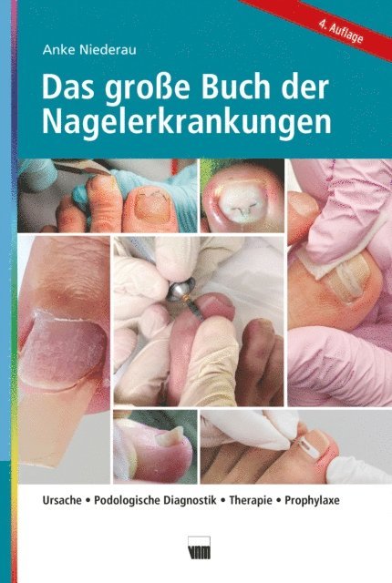 Anke Niederau - Das große Buch der Nagelerkrankungen, E-bok