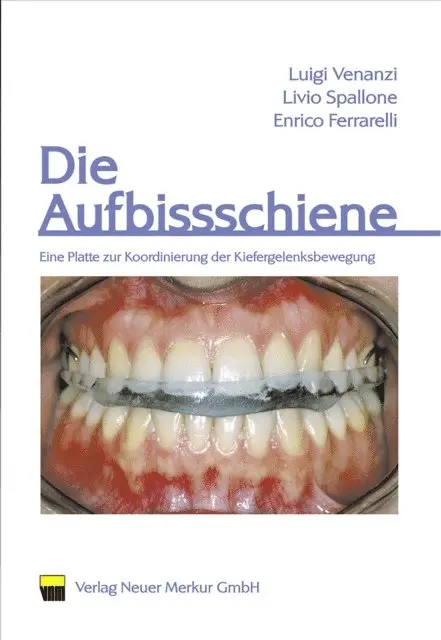 Enrico Ferrarelli, Livio Spallone, Luigi Venanzi - Die Aufbissschiene, E-bok. Tillgänglighet: Lägg i varukorg