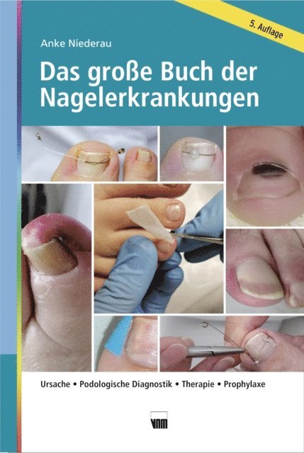 Anke Niederau - Das große Buch der Nagelerkrankungen, E-bok