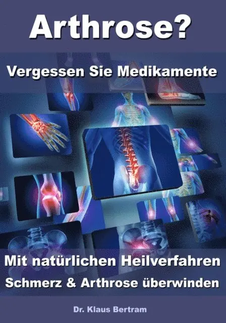 Dr. Klaus Bertram - Arthrose? – Vergessen Sie Medikamente – Mit natürlichen Heilverfahren Schmerz & Arthrose überwinden, E-bok. Tillgänglighet: Lägg i varukorg
