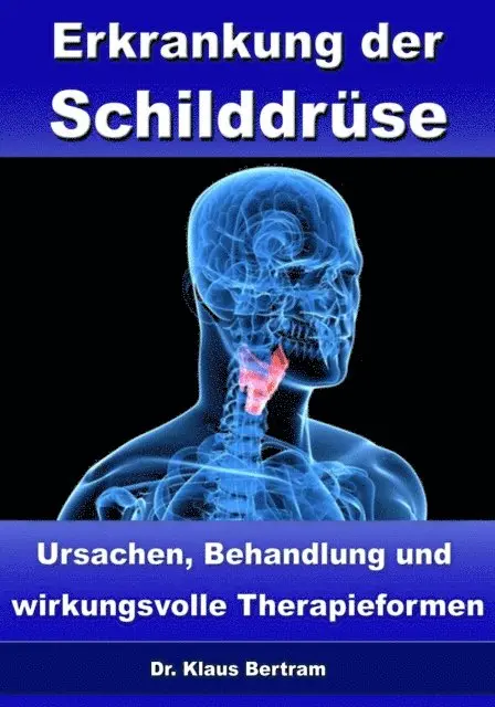 Dr. Klaus Bertram - Erkrankung der Schilddrüse – Ursachen, Behandlung und wirkungsvolle Therapieformen, E-bok. Tillgänglighet: Lägg i varukorg