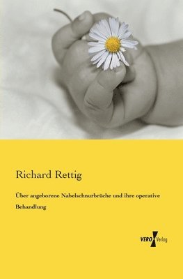 Richard Rettig - Über angeborene Nabelschnurbrüche und ihre operative Behandlung, Häftad. Tillgänglighet: Lägg i varukorg