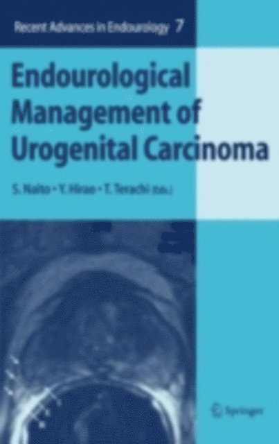 T. Terachi, Y. Hirao, S. Naito - Endourological Management of Urogenital Carcinoma, E-bok