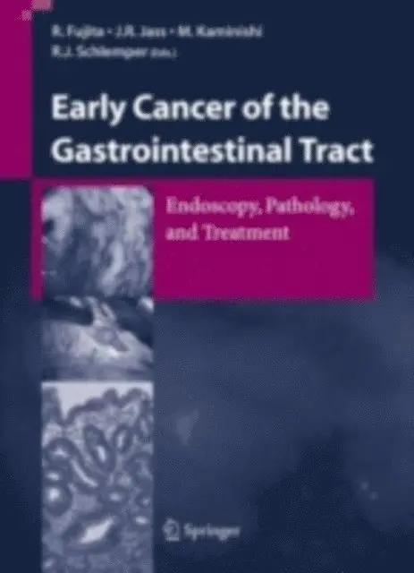 R.J. Schlemper, M. Kaminishi, J.R. Jass, R. Fujita - Early Cancer of the Gastrointestinal Tract, E-bok. Tillgänglighet: Lägg i varukorg