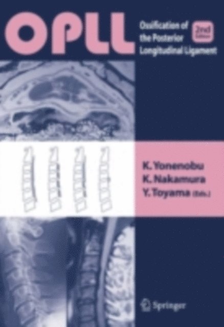 Y. Toyama, K. Nakamura, K. Yonenobu - OPLL, E-bok