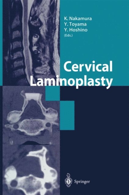 Y. Hoshino, Y. Toyama, K. Nakamura - Cervical Laminoplasty, E-bok