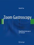 Zoom Gastroscopy