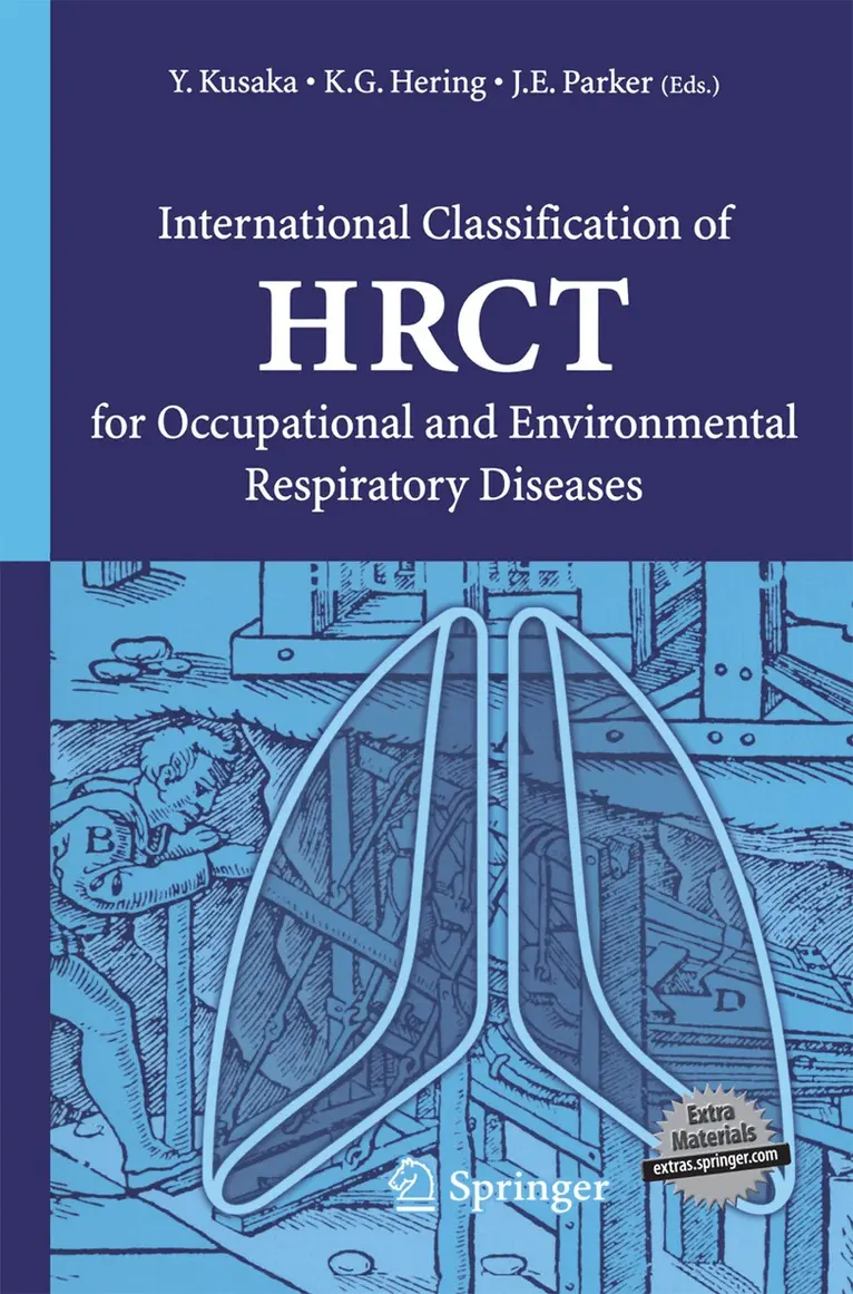Yukinori Kusaka, Kurt G. Hering, John E. Parker - International Classification of HRCT for Occupational and Environmental Respiratory Diseases, Häftad. Tillgänglighet: Lägg i varukorg