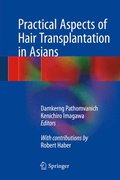 Practical Aspects of Hair Transplantation in Asians