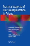 Practical Aspects of Hair Transplantation in Asians