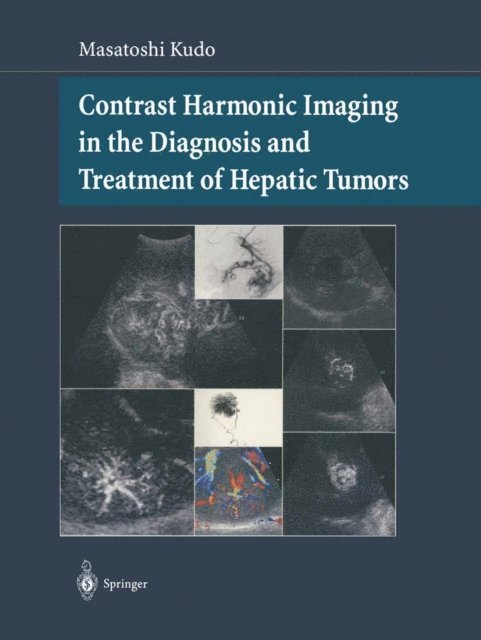 Masatoshi Kudo - Contrast Harmonic Imaging in the Diagnosis and Treatment of Hepatic Tumors, E-bok