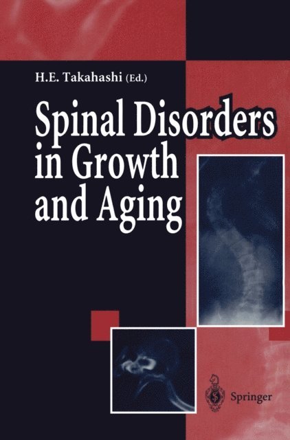 Hideaki E. Takahashi - Spinal Disorders in Growth and Aging, E-bok. Tillgänglighet: Lägg i varukorg