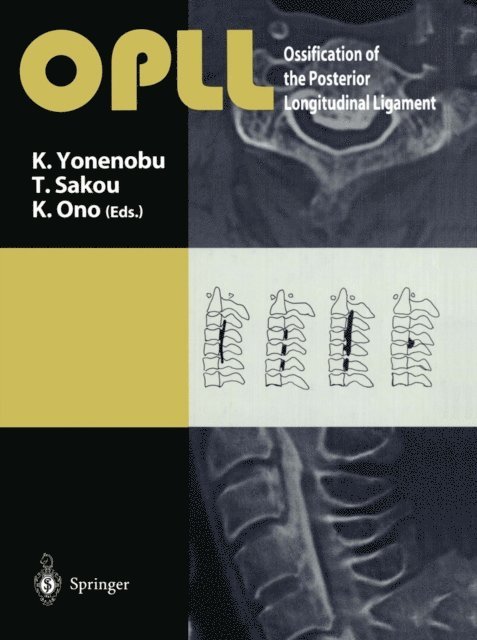 Keiro Ono, Takashi Sakou, K. Yonenobu - OPLL, E-bok