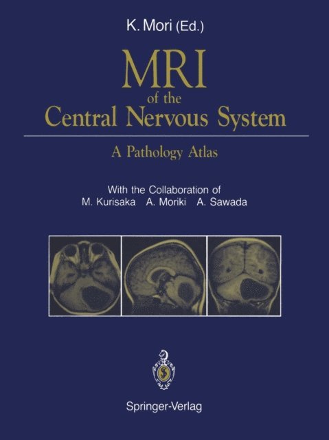 Koreaki Mori - MRI of the Central Nervous System, E-bok