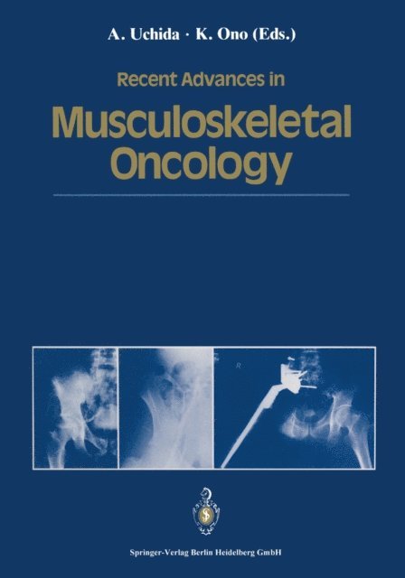 Keiro Ono, Atsumasa Uchida - Recent Advances in Musculoskeletal Oncology, E-bok