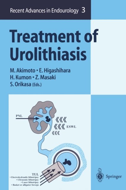 S. Orikasa, Z. Masaki, H. Kumon, E. Higashihara, M. Akimoto - Treatment of Urolithiasis, E-bok