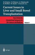 Current Issues in Liver and Small Bowel Transplantation