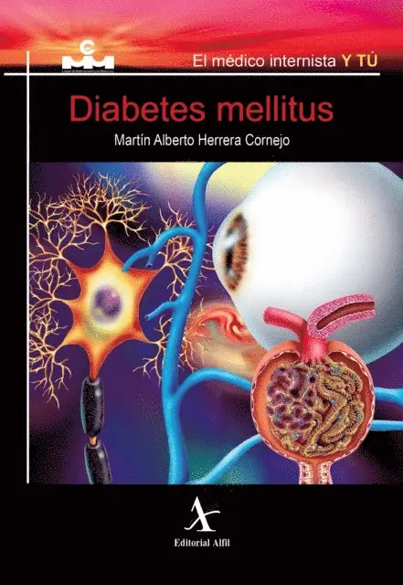 Martin Alberto Herrera Cornejo - Diabetes mellitus, E-bok. Tillgänglighet: Lägg i varukorg