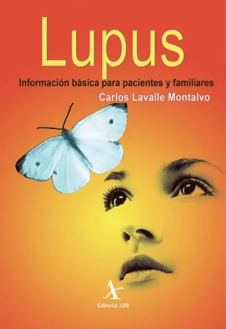 Carlos Lavalle Montalvo - Lupus. Información básica para pacientes familiares, E-bok. Tillgänglighet: Lägg i varukorg