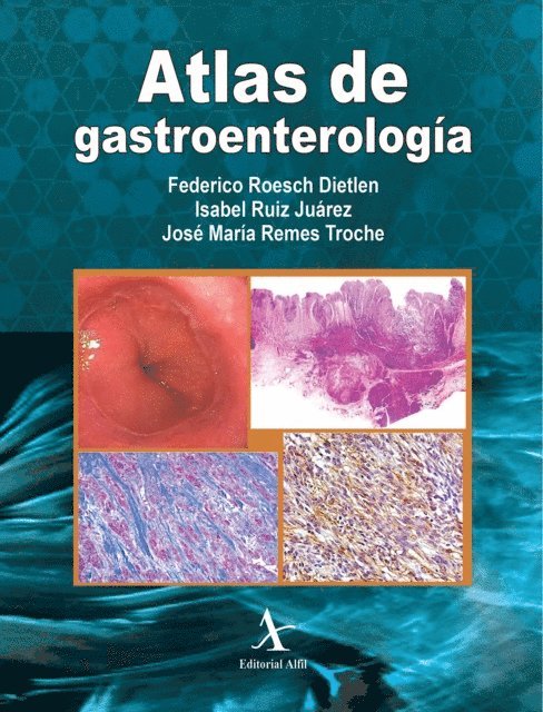 Jose Maria Remes Troche, Isabel Ruiz Juarez, Federico Roesch Dietlen - Atlas de gastroenterología, E-bok. Tillgänglighet: Lägg i varukorg