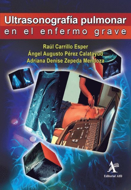 Adriana Denise Zepeda Mendoza, Angel Augusto Perez Calatayud, Raul Carrillo Esper - Ultrasonografía pulmonar en el enfermo grave, E-bok