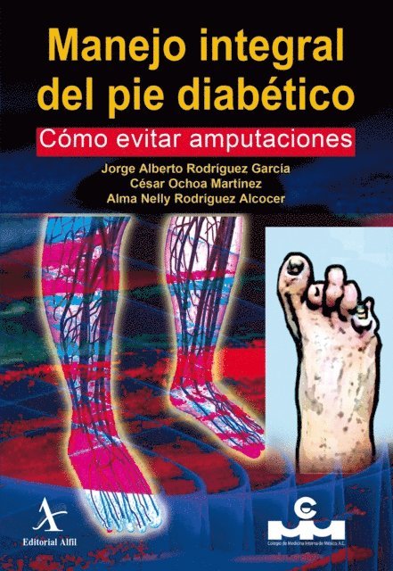 Alma Nelly Rodriguez Alcocer, Cesar Ochoa Martinez, Jorge Alberto Rodriguez Garcia - Manejo integral del pie diabetico. Como evitar amputaciones, E-bok
