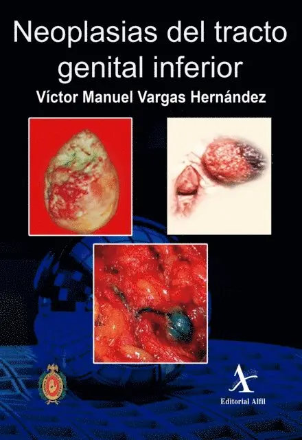 Victor Manuel Vargas Hernandez - Neoplasias del tracto genital inferior, E-bok. Tillgänglighet: Lägg i varukorg