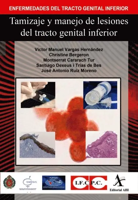 Jose Antonio Ruiz Moreno, Santiago Dexeus i Trias de Bes, Montserrat Cararach Tur, Christine Bergeron, Victor Manuel Vargas Hernandez - Tamizaje y manejo de lesiones del tracto genital inferior, E-bok. Tillgänglighet: Lägg i varukorg