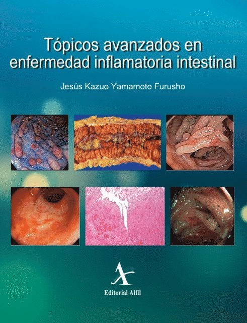 Jesus Kazuo Yamamoto Furusho - Topicos avanzados en enfermedad inflamatoria intestinal, E-bok. Tillgänglighet: Lägg i varukorg