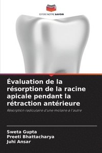 valuation de la rsorption de la racine apicale pendant la rtraction antrieure