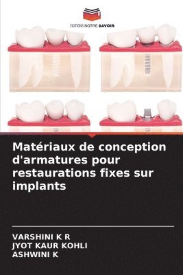 Varshini K R, Jyot Kaur Kohli, Ashwini K - Matériaux de conception d'armatures pour restaurations fixes sur implants, Häftad. Tillgänglighet: Lägg i varukorg