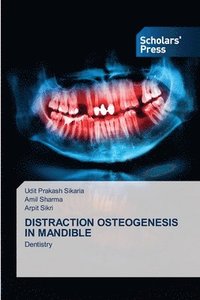 Distraction Osteogenesis in Mandible
