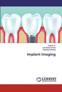 Implant Imaging