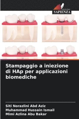 Siti Norazlini Abd Aziz, Muhammad Hussain Ismail, Mimi Azlina Abu Bakar - Stampaggio a iniezione di HAp per applicazioni biomediche, Häftad
