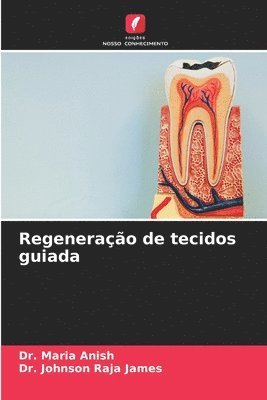 Maria Anish, Johnson Raja James - Regeneração de tecidos guiada, Häftad