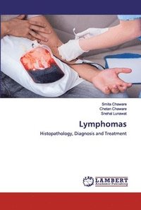 Lymphomas