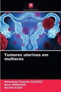 Tumores uterinos em mulheres